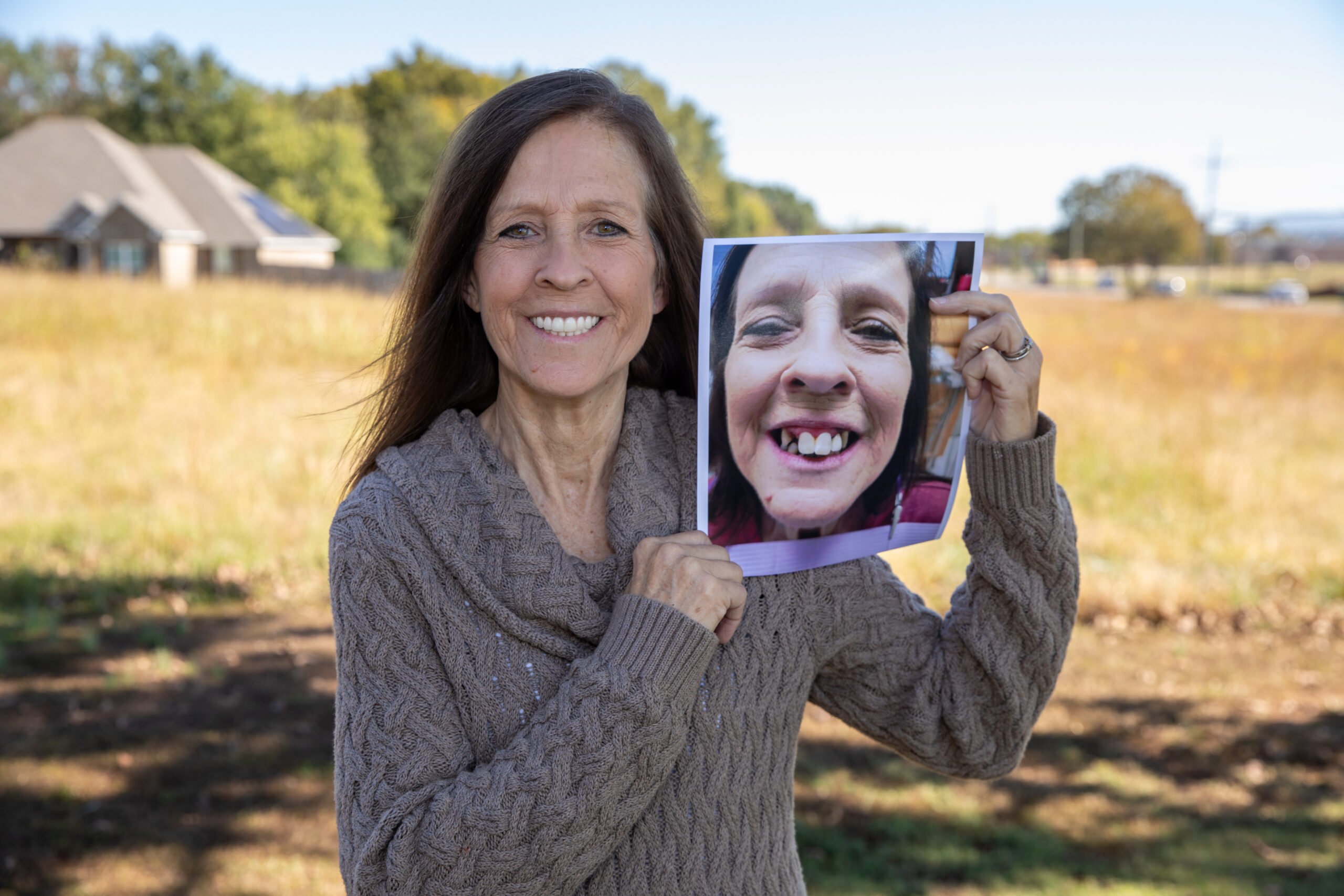 Real patient smiling showing her before photo with her smile